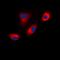 Sodium Voltage-Gated Channel Alpha Subunit 8 antibody, orb214558, Biorbyt, Immunofluorescence image 