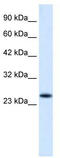 Charged multivesicular body protein 3 antibody, TA335568, Origene, Western Blot image 