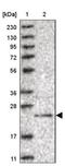 Coiled-Coil Domain Containing 115 antibody, NBP1-86568, Novus Biologicals, Western Blot image 