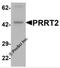 Proline Rich Transmembrane Protein 2 antibody, 7295, ProSci Inc, Western Blot image 