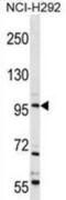 Transient Receptor Potential Cation Channel Subfamily C Member 4 antibody, abx029045, Abbexa, Western Blot image 