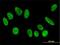 F-Box Protein 11 antibody, H00080204-M01, Novus Biologicals, Immunofluorescence image 
