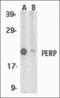 P53 Apoptosis Effector Related To PMP22 antibody, orb87345, Biorbyt, Western Blot image 