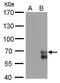 Zinc Finger Protein 703 antibody, GTX628897, GeneTex, Western Blot image 