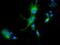 Aldehyde Dehydrogenase 1 Family Member L1 antibody, NBP2-03143, Novus Biologicals, Immunofluorescence image 
