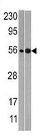 NMD3 Ribosome Export Adaptor antibody, AP11767PU-N, Origene, Western Blot image 