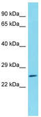 Chromosome 1 Open Reading Frame 105 antibody, TA333525, Origene, Western Blot image 