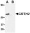 CD294 antibody, MBS150173, MyBioSource, Western Blot image 