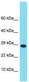 H2B Histone Family Member M antibody, TA332166, Origene, Western Blot image 