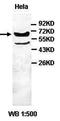 ATP Binding Cassette Subfamily D Member 3 antibody, orb77578, Biorbyt, Western Blot image 
