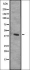 C-X-C Motif Chemokine Receptor 3 antibody, orb335154, Biorbyt, Western Blot image 