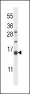 Natriuretic Peptide C antibody, 57-428, ProSci, Western Blot image 