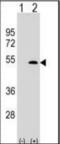 Fibrinogen Gamma Chain antibody, orb73668, Biorbyt, Western Blot image 