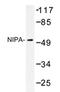 Zinc Finger C3HC-Type Containing 1 antibody, AP20366PU-N, Origene, Western Blot image 