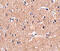 Polypeptide N-Acetylgalactosaminyltransferase 10 antibody, 5281, ProSci Inc, Immunohistochemistry paraffin image 