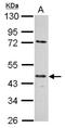 E2F-1 antibody, NB600-209, Novus Biologicals, Western Blot image 