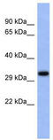 Upstream Transcription Factor 1 antibody, TA337301, Origene, Western Blot image 