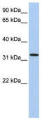 Family With Sequence Similarity 216 Member A antibody, TA334473, Origene, Western Blot image 