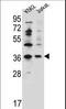 Putative protein phosphatase 1 regulatory inhibitor subunit 3G antibody, LS-C162084, Lifespan Biosciences, Western Blot image 