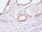 DExD-Box Helicase 39B antibody, A53845-100, Epigentek, Immunohistochemistry paraffin image 
