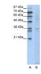 Cyclin B3 antibody, NBP1-80127, Novus Biologicals, Western Blot image 