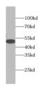 Galactosidase Alpha antibody, FNab00328, FineTest, Western Blot image 