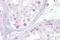 Hmr antibody, ARP31941_T100, Aviva Systems Biology, Immunohistochemistry frozen image 
