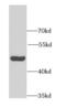 Dihydroorotate Dehydrogenase (Quinone) antibody, FNab02367, FineTest, Western Blot image 