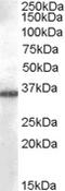 Cytochrome P450 19A1 antibody, orb19742, Biorbyt, Western Blot image 