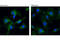 Protein Kinase D2 antibody, 8188S, Cell Signaling Technology, Immunocytochemistry image 