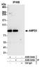 Adenosine Monophosphate Deaminase 3 antibody, A305-544A, Bethyl Labs, Immunoprecipitation image 