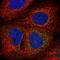 Armadillo Like Helical Domain Containing 3 antibody, NBP2-30723, Novus Biologicals, Immunocytochemistry image 