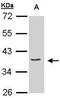 Eukaryotic translation initiation factor 3 subunit M antibody, PA5-28447, Invitrogen Antibodies, Western Blot image 
