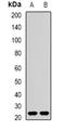 Receptor Accessory Protein 1 antibody, orb382006, Biorbyt, Western Blot image 