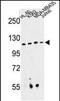 RPGR Interacting Protein 1 antibody, PA5-49651, Invitrogen Antibodies, Western Blot image 