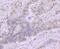 Casein kinase II subunit beta antibody, A03475, Boster Biological Technology, Immunohistochemistry paraffin image 