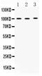 ADAM Metallopeptidase Domain 2 antibody, A08379-1, Boster Biological Technology, Western Blot image 