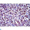 Jun Proto-Oncogene, AP-1 Transcription Factor Subunit antibody, LS-C812499, Lifespan Biosciences, Immunohistochemistry paraffin image 