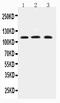 Transient Receptor Potential Cation Channel Subfamily C Member 4 antibody, PA2307, Boster Biological Technology, Western Blot image 