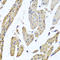 Mitochondrial Ribosomal Protein L12 antibody, A10395-2, Boster Biological Technology, Immunohistochemistry paraffin image 