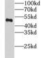 LSM11, U7 Small Nuclear RNA Associated antibody, FNab04872, FineTest, Western Blot image 