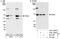 Gamma-PAK antibody, A301-263A, Bethyl Labs, Immunoprecipitation image 