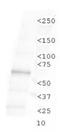 Toll Like Receptor 4 antibody, NBP1-78427, Novus Biologicals, Western Blot image 