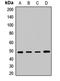 Vacuolar Protein Sorting 4 Homolog A antibody, LS-C668528, Lifespan Biosciences, Western Blot image 