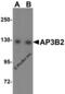 Adaptor Related Protein Complex 3 Subunit Beta 2 antibody, 6395, ProSci, Western Blot image 