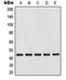 Mitogen-Activated Protein Kinase Kinase 4 antibody, LS-C352842, Lifespan Biosciences, Western Blot image 