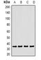 CLEC12A antibody, abx225112, Abbexa, Western Blot image 