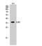 DNA Fragmentation Factor Subunit Alpha antibody, A03671-1, Boster Biological Technology, Western Blot image 