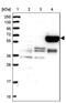 Methyltransferase Like 25 antibody, PA5-58830, Invitrogen Antibodies, Western Blot image 