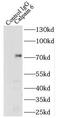 Calpain 6 antibody, FNab01216, FineTest, Immunoprecipitation image 